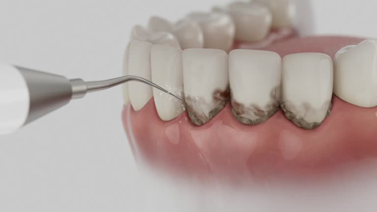 Reliable Dental contractor in Louisville, OH by Dentist Open Now
